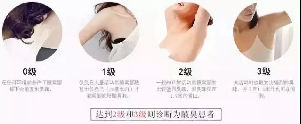 告别尴尬，这个夏季有品位没异味！