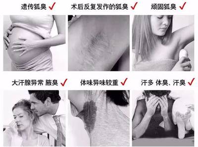 印度神药？狐臭新解还是营销噱头？科学看待异味困扰