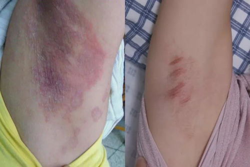 轻轻一喷，告别困扰 科学应对爱出汗与体味重问题